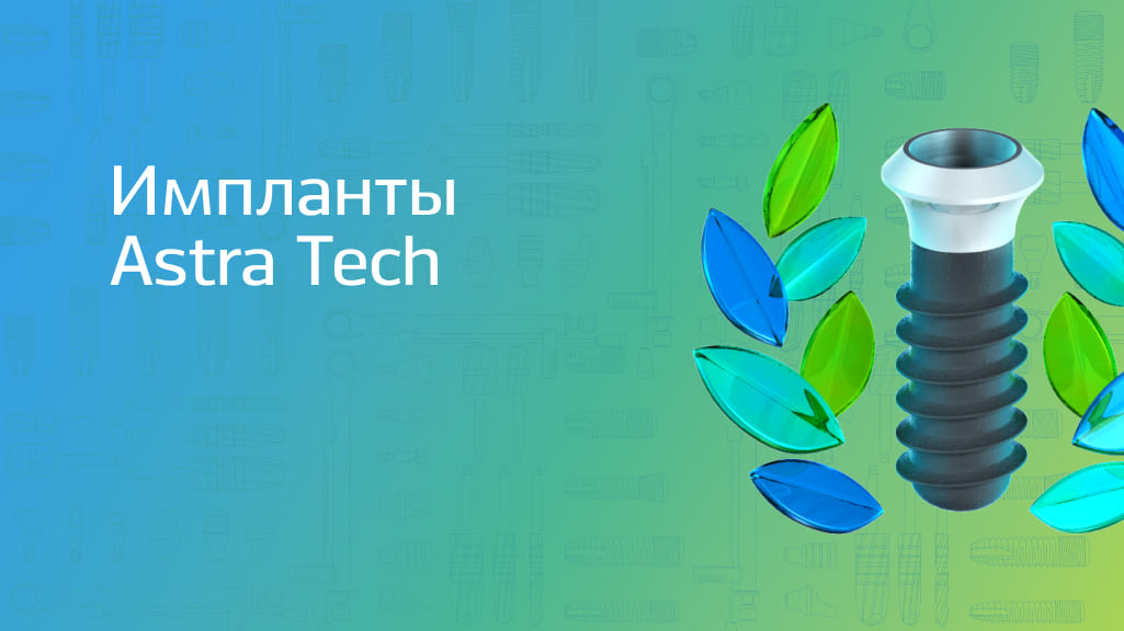 Импланты Astra Tech: система, проверенная временем