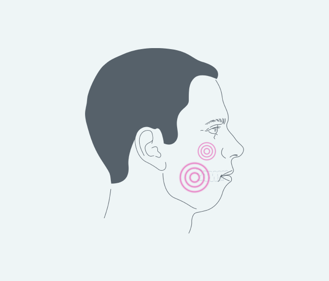 Переломы челюстей и скул.png