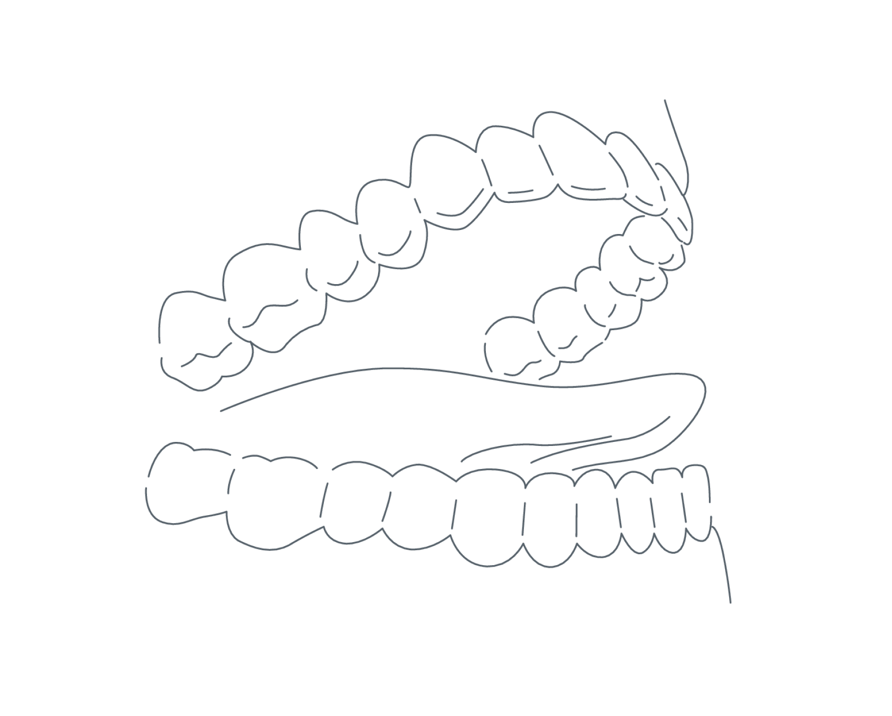 Ортодонтия_техИллюстр_1_6 (2).png