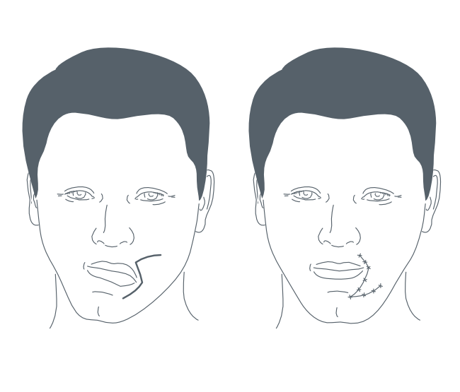 Шрам (1).png